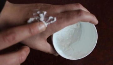 Kaşıntı, kızarıklık ve kurulukla ortaya &ccedil;ıkıyor! Soğuk yanıklarına dikkat