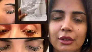 Kirpik yaptırmak isteyen kadının hayatı kabusa döndü: Kör olacaktı!