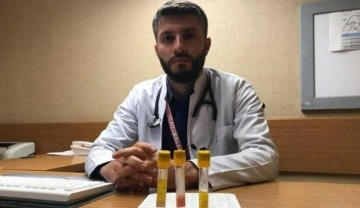 Kolesterol&uuml;n &ouml;nemi ortaya &ccedil;ıktı: Y&uuml;ksekse kan bulanık ve katı, d&uuml;ş&uuml;kse kan berrak