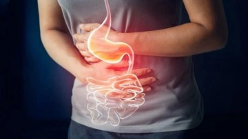 Mideniz yanıyorsa dikkat! Midede yanmaya ve ekşimeye bunlar yol a&ccedil;ıyor...
