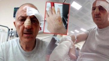 Önce icra yoluyla evinden tahliye edildi, ardından darp edildi