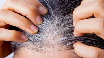 Sa&ccedil; beyazlamasına son! İbn-i Sina&rsquo;dan 3 &ouml;nemli yağ &ouml;nerisi&hellip;