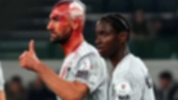 Sahada kanlar içinde kaldı! Formasını değişip maça devam etti