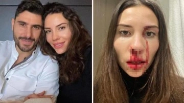 Şiddet gerek&ccedil;esiyle &Ouml;zer Hurmacı'dan şikayet&ccedil;i olan Mihriban Hurmacı: 500 TL ile ortada kaldım