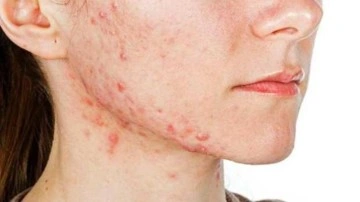 Sivilcelerinizle sakın oynamayın! &Uuml;rk&uuml;t&uuml;c&uuml; sonucu duyunca &ccedil;ok şaşıracaksınız