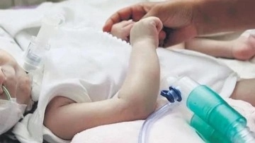 SMA&rsquo;lı hasta sayısı azaldı