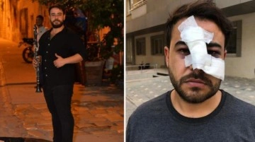 Sokak sanatçısının yüzünde şişe kırıp pişkince "Biz sana mı vurduk" diye sormuşlar