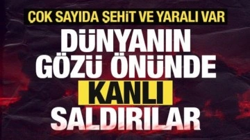 Son dakika: Dünyanın gözü önünde kanlı saldırılar! Çok sayıda şehit ve yaralı var...