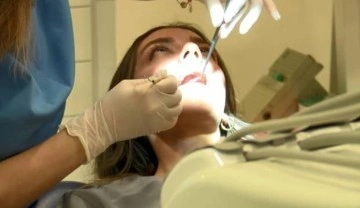 Son zamanların pop&uuml;ler diş beyazlatma akımına dikkat! &Ouml;l&uuml;me kadar g&ouml;t&uuml;r&uuml;yor