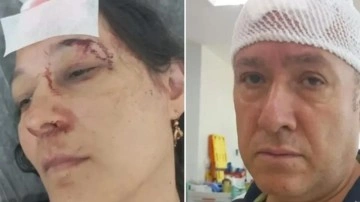 Tatilde kabusu yaşadılar! Demir sopalarla dövülüp hastanelik oldular