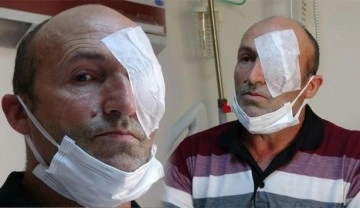 Trabzon'da 30 yıl sonra ilk kez ger&ccedil;ekleşti: Kornea nakli