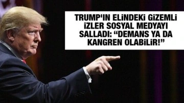 Trump'ın elindeki gizemli izler sosyal medyayı salladı: “Demans ya da kangren olabilir!”