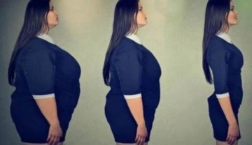 T&uuml;p mide ameliyatı ile yeni birine d&ouml;n&uuml;şmek m&uuml;mk&uuml;n m&uuml;?