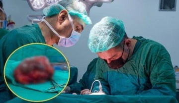 &Uuml;lkesinde iyileşemeyen Sudanlı hasta şifayı T&uuml;rkiye'de buldu! 25 santimlik t&uuml;m&ouml;r &ccedil;ıkarıldı