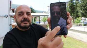Üstündeki 25 ölümcül keneyi selfie çekerken fark etti!