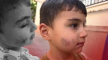 Uyurken dehşeti yaşadı: Lağım faresi ısıran çocuğa kuduz aşısı yapıldı!