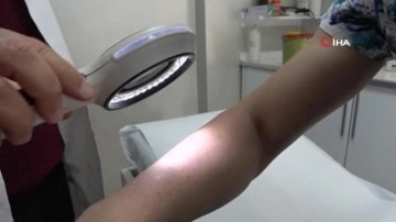 Uzmanlardan uyarı: "Uyuz, 15-20 yılda bir t&uuml;m d&uuml;nyada salgın halinde g&ouml;z&uuml;kebilir"